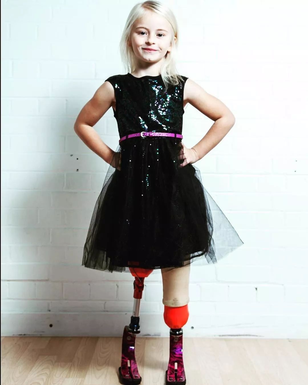 截肢仙女紅遍全球