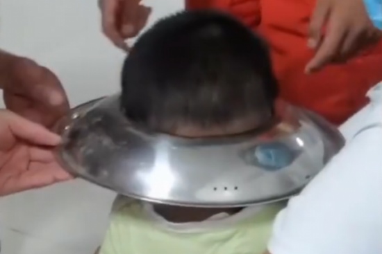 男孩腦袋卡進鍋蓋取不下來