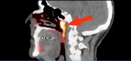 科學(xué)家在人體內(nèi)發(fā)現(xiàn)未知新器官