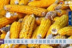 女子接觸霉變玉米后肺部長滿真菌