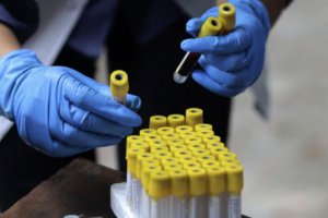 德國實驗室測試發現某些抗體療法對Omicron變種無效