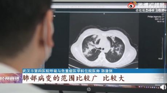 女子接觸霉變玉米后肺部長滿真菌