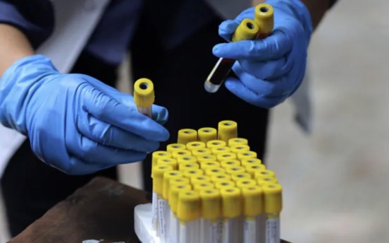 德國實驗室測試發(fā)現(xiàn)某些抗體療法對Omicron變種無效