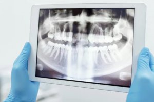 女子拔錯(cuò)牙墜亡：安慶市立醫(yī)院醫(yī)生拔錯(cuò)牙事件